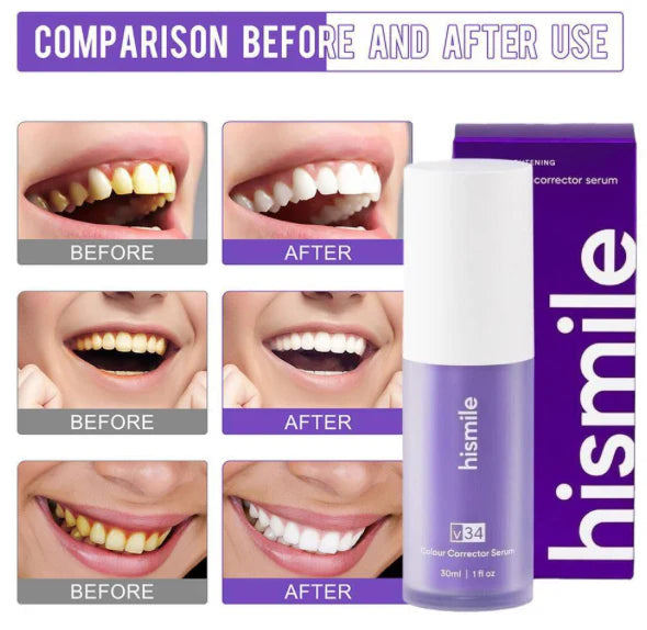 Teeth Whitening Booster